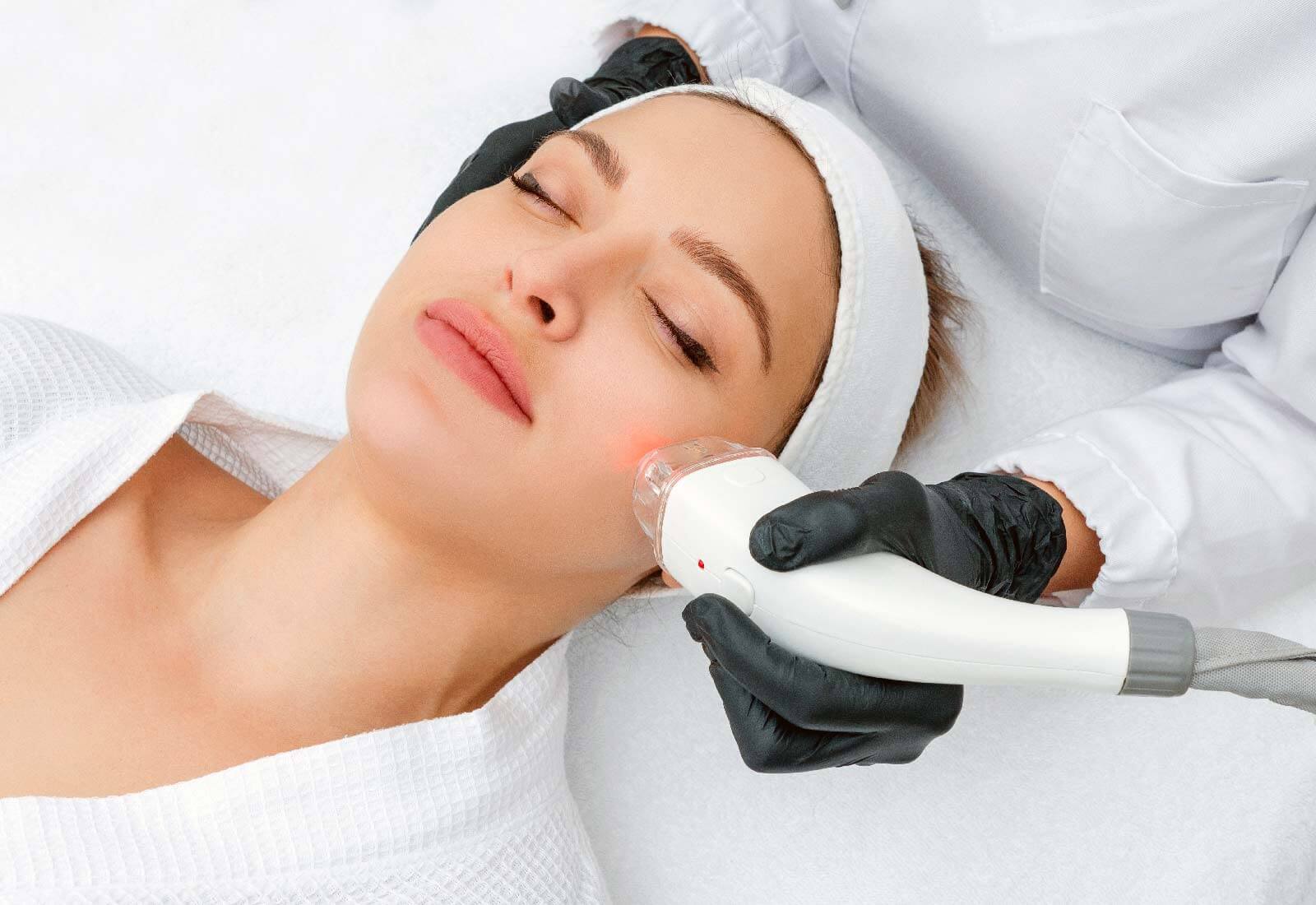 laser para la cara